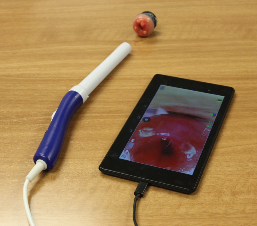 Pocket Colposcope with Cervix Image on Tablet