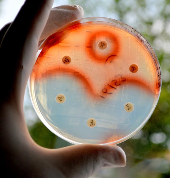 Antibiotic sensitivity test of Serratia marcescens.