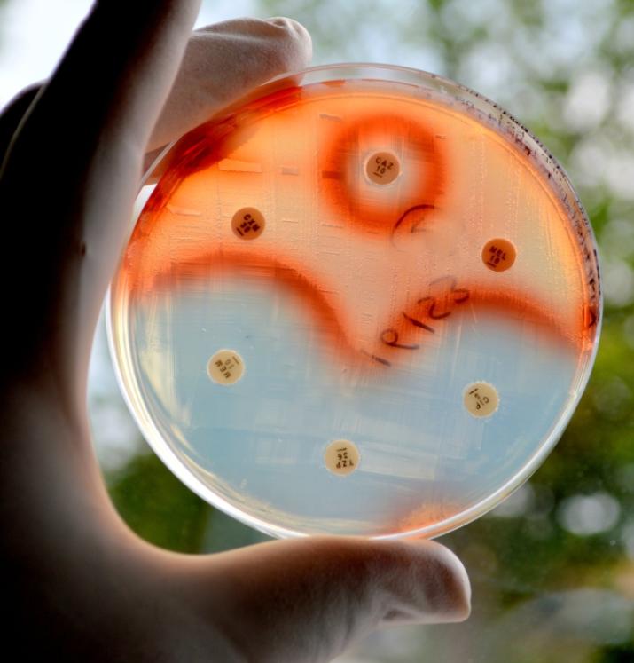 Antibiotic sensitivity test of Serratia marcescens. 