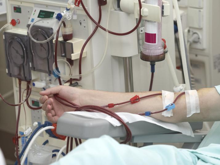 Dialysis_Machine
