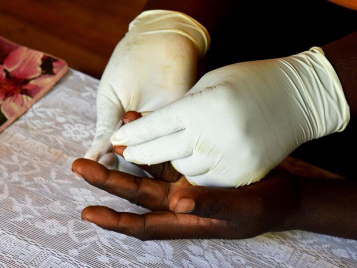 Rapid Diagnostic Test for Malaria