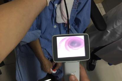 Flexible nasopharyngoscope with monitor