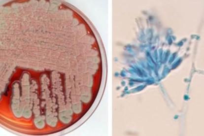 cells in dish